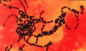 Lactobacillus GG Mikroskop