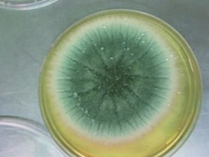 Mukoviszidose Makroskopische Aufnahme Aspergillus fumigatus